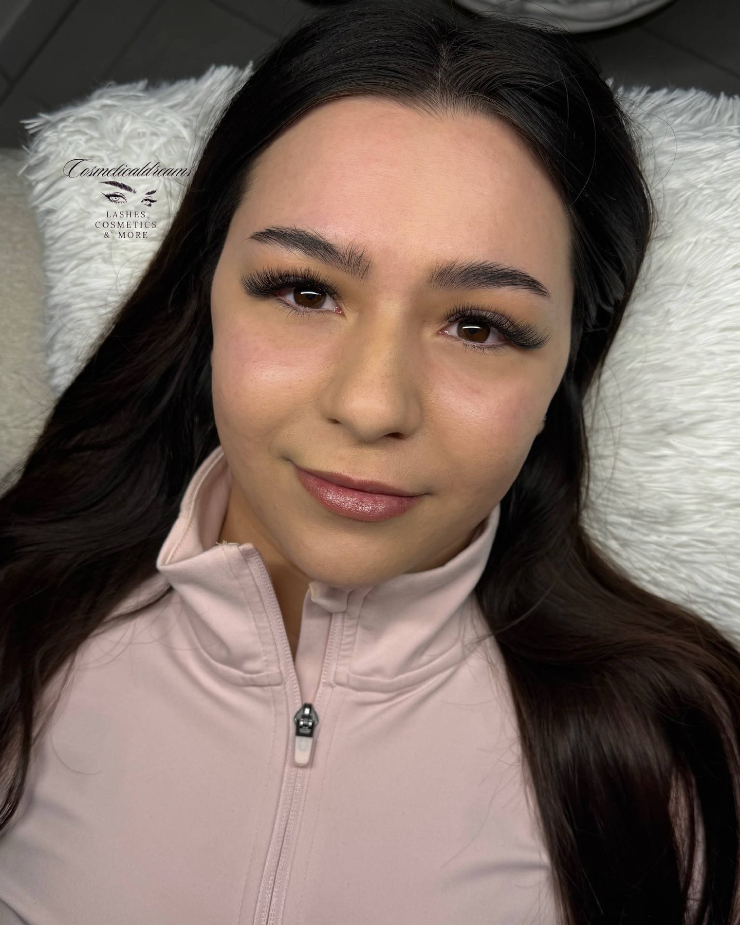 Mikrodermabrasion